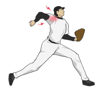 フォームが崩れる原因は体幹かも？野球肩・野球肘を根本から考える