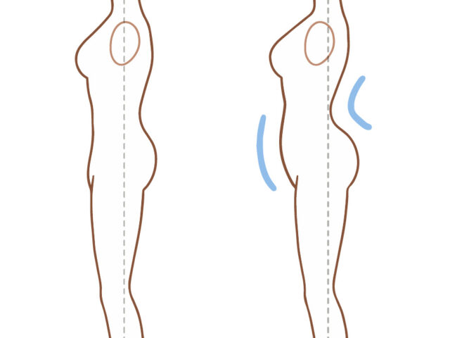 反り腰の人の特徴と対策｜反り腰から来る腰痛を改善へ